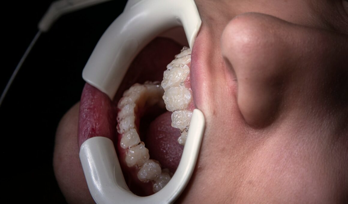a close up of a person's mouth with a dental device attached to it