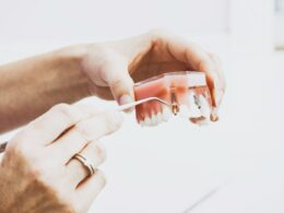 person wearing silver-colored ring while holding denture
