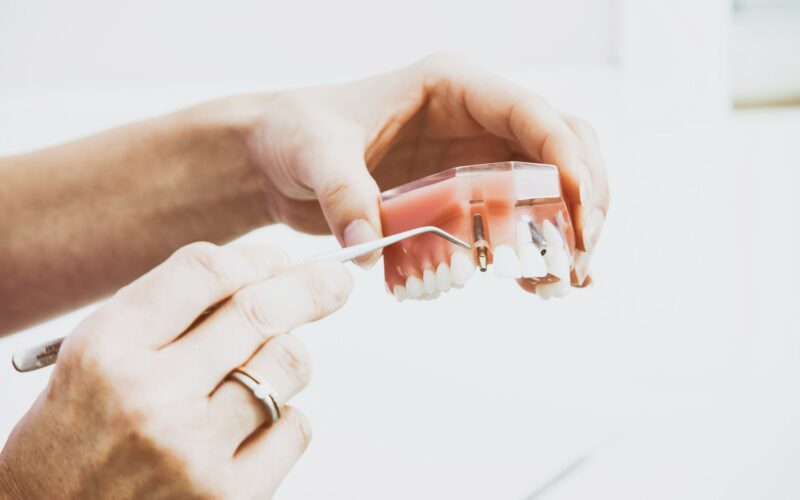 person wearing silver-colored ring while holding denture